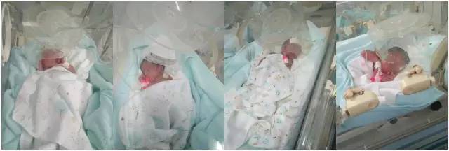 双胞胎+早产4胞胎！30万治疗费难倒这对山东夫妻