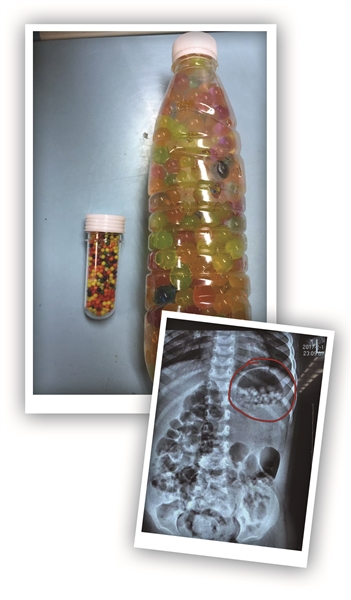 家人把“水宝宝”当五彩糖喂孩子 女童误吃280多颗